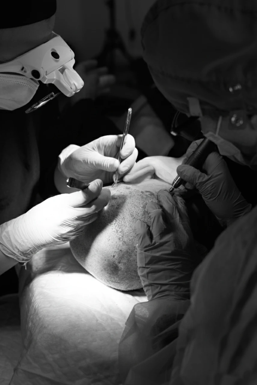 implante de pelo ceuta