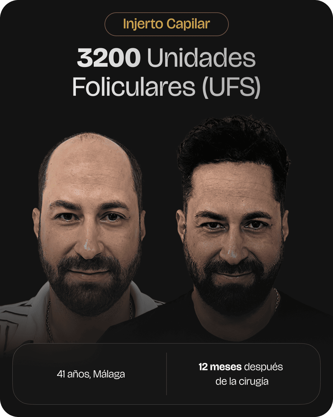 CAPILARIS - before-after-web-caso-7
